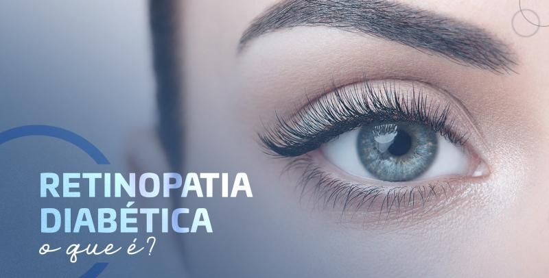 O que é Retinopatia Diabética?